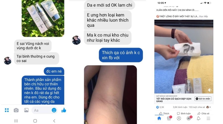 triệt lông thảo được tavida có tốt không