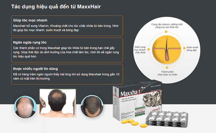 công dụng viên maxxhair