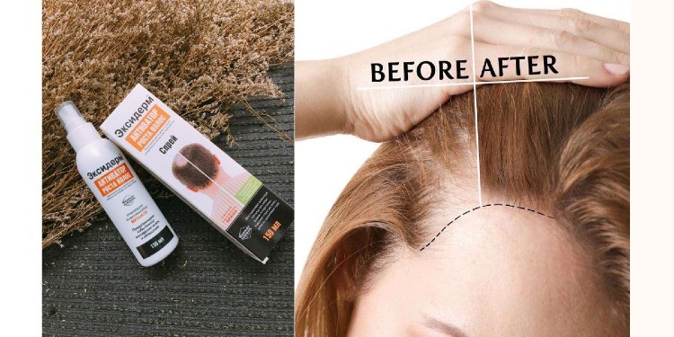 Xịt hỗ trợ mọc tóc, trị hói Eksiderm
