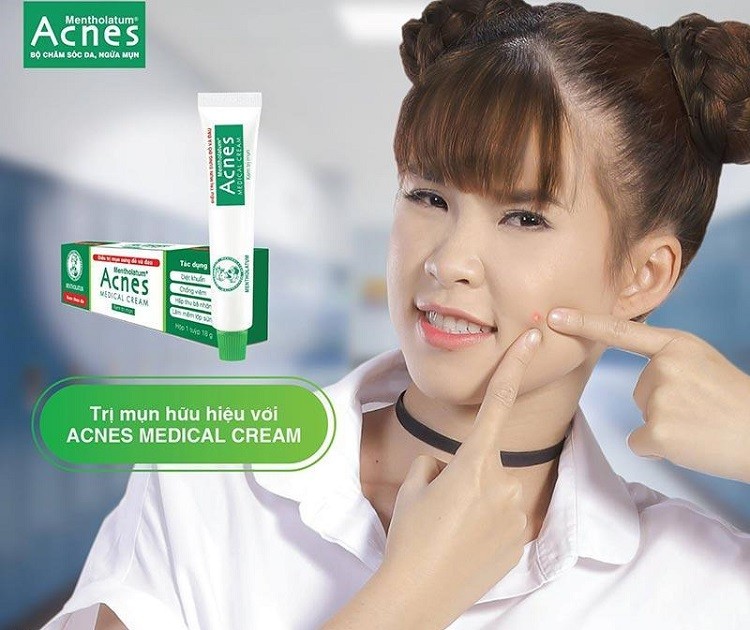 kem trị mụn Acnes có tốt không kem trị mụn Acnes có tốt không, kem trị mụn Acnes review, kem trị mụn Acnes có tốt không webtretho, kem trị mụn yoosun Acnes có tốt không, kem trị mụn anti acne cream có tốt không, kem trị mụn Acnes giá bao nhiêu, kem trị mụn vernicers acne giá bao nhiêu, kem trị mụn herbal acne của ấn độ review