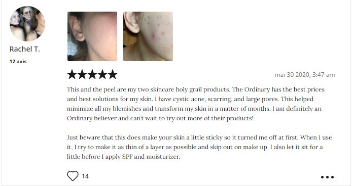 The Ordinary Niacinamide 10 + Zinc 1 review the ordinary niacinamide 10 + zinc 1, the ordinary niacinamide 10 + zinc 1 review, the ordinary niacinamide 10 + zinc 1 30ml, serum the ordinary niacinamide 10 + zinc 1, serum the ordinary niacinamide 10 + zinc 1 review, cara pakai the ordinary niacinamide 10 + zinc 1, the ordinary niacinamide 10 + zinc 1 serum, the ordinary niacinamide 10 + zinc 1 opiniones, cách dùng the ordinary niacinamide 10 + zinc 1, the ordinary niacinamide 10 + zinc 1 sheis, the ordinary niacinamide 10 + zinc 1 fake, manfaat serum the ordinary niacinamide 10 + zinc 1, serum the ordinary niacinamide 10 + zinc 1 30ml, serum the ordinary niacinamide 10 + zinc 1 giá, harga serum the ordinary niacinamide 10 + zinc 1, serum the ordinary niacinamide 10 + zinc 1 fake, serum the ordinary niacinamide 10 + zinc 1 sheis, best serum the ordinary niacinamide 10 + zinc 1, the ordinary niacinamide 10 + zinc 1 cara pakai, serum the ordinary niacinamide 10 + zinc 1 mint07, serum the ordinary niacinamide 10 zinc 1 review sheis