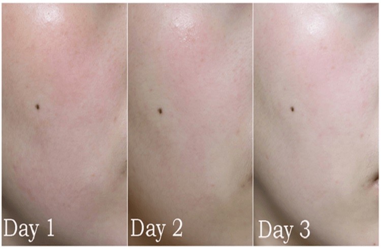 Review Skin1004 Madagascar Centella Skin1004 Madagascar Centella Asiatica Cream review, review Skin1004 Madagascar Centella Asiatica Cream, Skin1004 Madagascar Centella Asiatica Cream ingredients, skin1004 madagascar centella cream, Skin1004 Madagascar Centella Asiatica Cream skincarisma, Skin1004 Madagascar Centella Asiatica Cream review indonesia