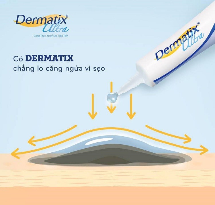 Kem trị sẹo Dermatix review kem trị sẹo Dermatix review, kem trị sẹo Dermatix giá bao nhiêu, kem trị sẹo Dermatix có trị thâm không, kem trị sẹo Dermatix của mỹ, review kem trị sẹo Dermatix, bôi sẹo Dermatix, kem trị sẹo bỏng Dermatix, kem bôi sẹo Dermatix, kem trị sẹo Dermatix 7g, kem trị sẹo Dermatix bán ở đâu, Dermatix trị sẹo lồi, kem trị sẹo Dermatix giá, kem trị sẹo Dermatix có tốt không, kem trị sẹo Dermatix ultra có tốt không