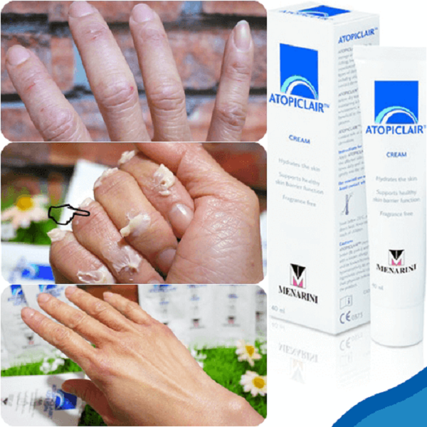 lotion atopiclair,kem dưỡng ẩm atopiclair,dưỡng ẩm atopiclair,thuốc atopiclair, sữa dưỡng ẩm atopiclair